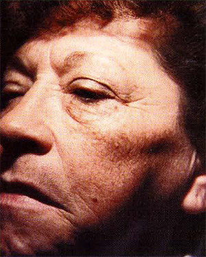 rose-hip-after.jpg