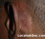 man_ear_after.jpg