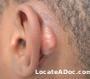 man_ear_before.jpg