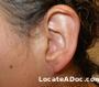 woman_ear_after.jpg