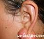 woman_ear_before.jpg
