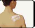 View: Small Scar Removal
