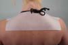 View: Shoulder Scar Treatment