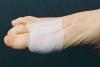 arm_scar_treatment_healing_sm.jpg