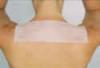 View: Silicone Scar Sheets &amp; Disks by Size