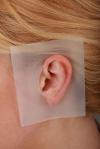 View: Ear Scar Healing