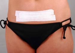 C-Section Scar Treatment Kits C-Section Scar Treatment Kits