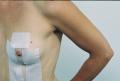 Two  Vertical 7 cm (2.75) Diameter 10 cm (4) Vertical Breast Pieces Irregular