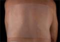 Scar Healing Silicone Sheet 30 cm x 30 cm (12" x 12")