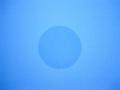 View: Acne Scar Healing Silicone Disc  4.25 cm (1.6") diameter (1 disc per package)