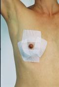 One Scar Healing  7 cm (2.75 ")  Diameter Breast Circle - Irregular