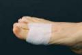 Rejuveness Tape 5.1 cm x 10.6 M (2 x 33) - Hypoallergenic
