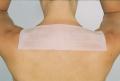 Scar  Healing Silicone Sheet 4 cm x 35.6 cm (1.6" x 14") Irregular