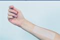 Scar Healing Silicone Sheet 4  cm x 18 cm  (1.6 x 7.2)