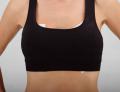 Breast Scar Treatment Kits