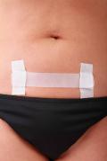 C-Section Scar Treatment Kits 