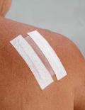 Small Silicone Sheet Treatment Kits 