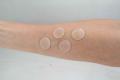  Adhesive Mini Silicone Discs For Insect Bites