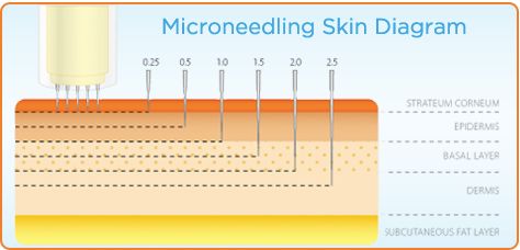 Derma Roller Size Chart