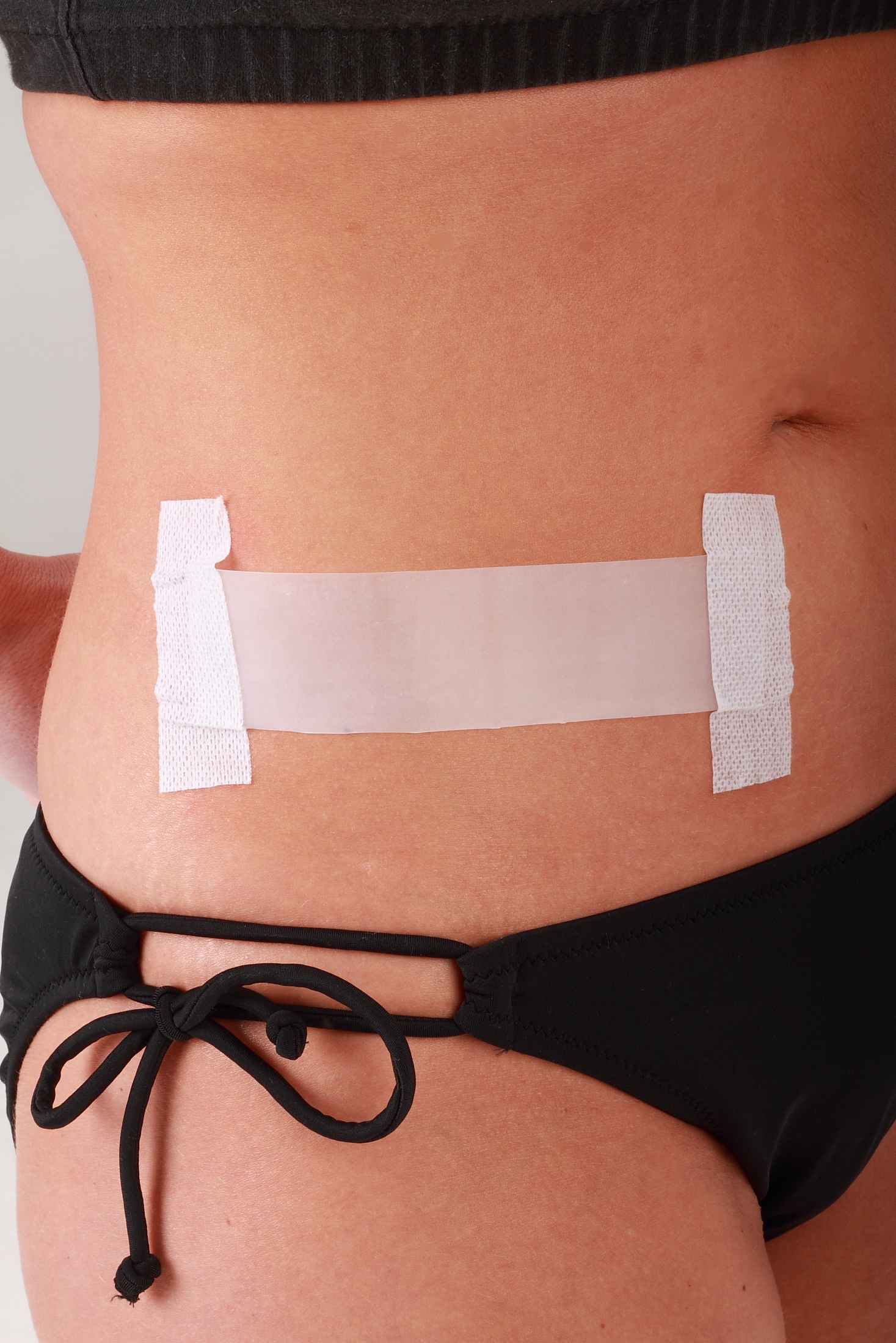  Tummy Tuck Post Surgery Supplies Kit - Silicone Scar