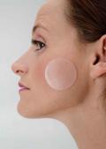 View: Small Acne Adhesive Silicone Discs 